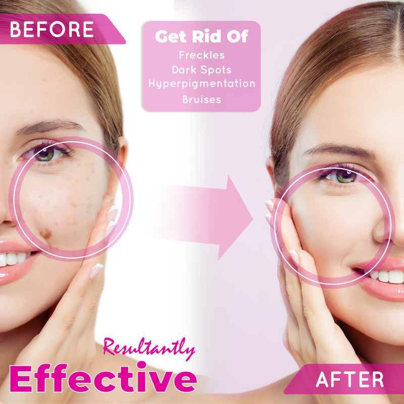 Fair And White So White
So White Skin Perfector Dark Spot Corrector Gel 30ml / 1 Oz.
